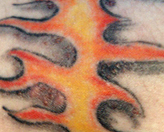 Infection sur un tatouage