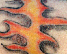 Risque tatouage : Risques infections, réactions allergiques et ...